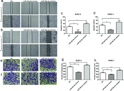 MiR 30e 5p Could Represse PCa Cells Migration And Invasion A B