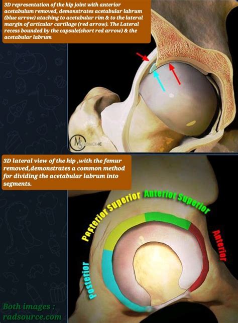 Acetabular Labrum