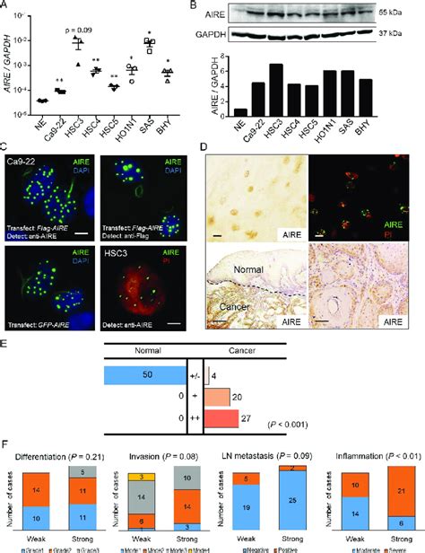 Aire Expression In Oscc A Real Time Rt Pcr Analysis Of Various Cancer