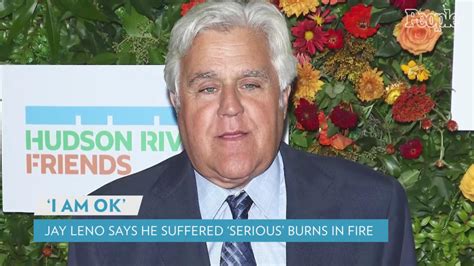 Jay Leno Says He Suffered Serious Burns After Being Involved In