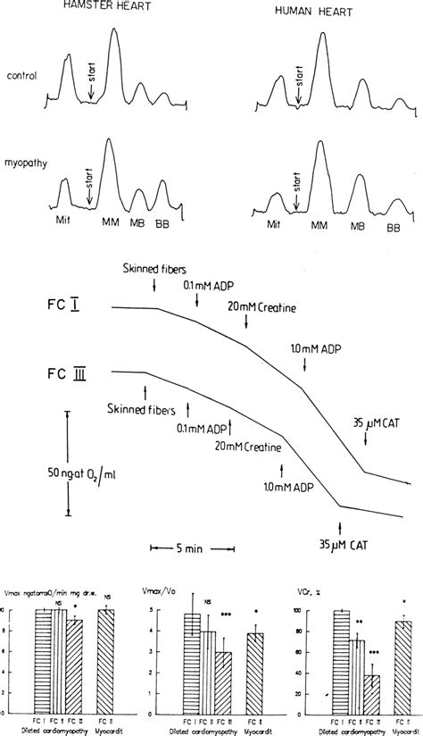 Analysis Of The Creatine Kinase Isoenzyme Profiles And Respiration In