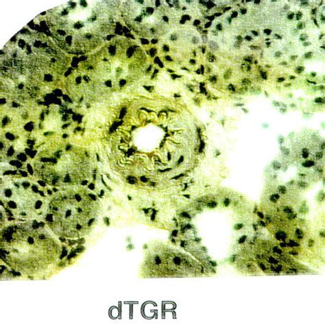 Representative Immunohistochemical Photomicrograph Of VLA 4 In The