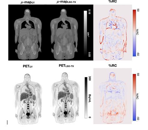 Snmmi Can Ultra Low Dose Pet Supplant The Need For Ct Attenuation