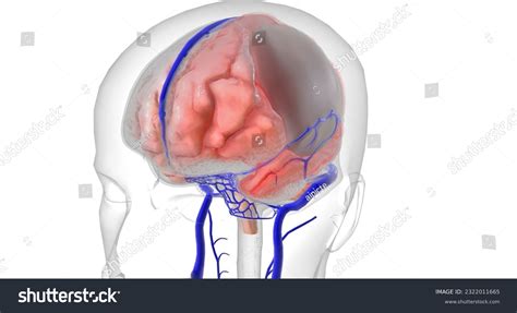 Arachnoid Mater Brain