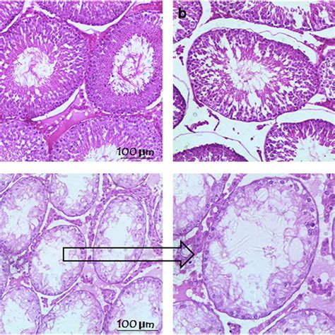 Photomicrographs Of Cross Sections Of The Testis Showing Seminiferous