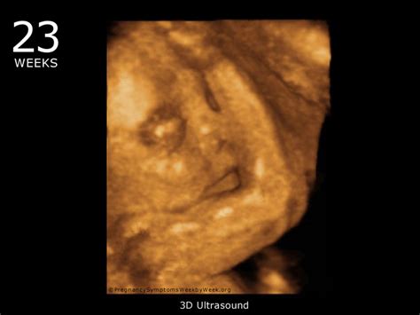 23 Week 3d Ultrasound Baby Picture Pregnancy Symptoms Week By Week