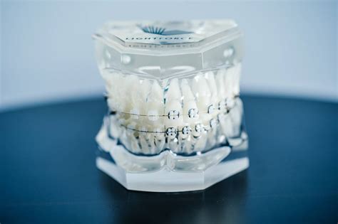 Lightforce Orthodontics Raises Million In Series C Funding Round