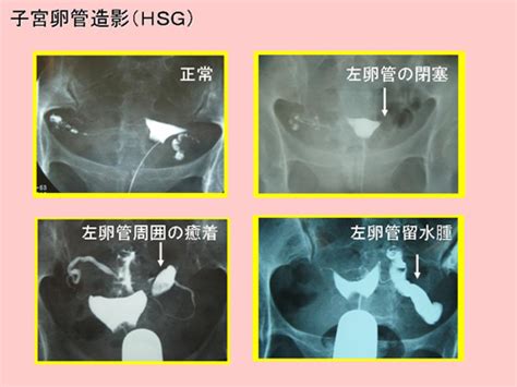 不妊治療に関する情報