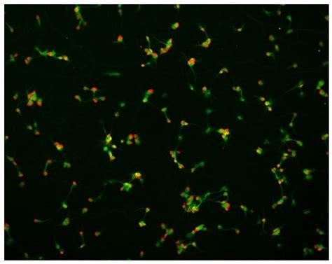 Spinal Motor Neuron Human IPSC Derived Cells GFP Expressing Male