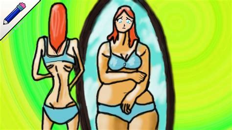 Trastornos Alimentarios Todo Lo Que Necesitas Saber Sobre La Anorexia