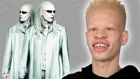 People With Albinism Review Albino Characters From Film Youtube