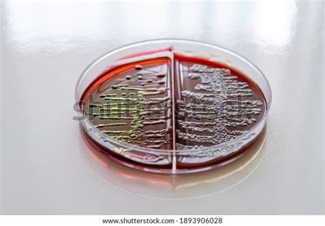 Characteristic Mucoid Colonies Klebsiella Pneumoniae On Stock Photo