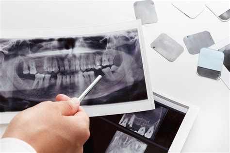 Dental X Rays Are They Safe Hardy Pediatric Dentistry Orthodontics