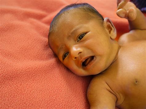 Amazing Info About How To Reduce Jaundice In Newborn Settingtooth