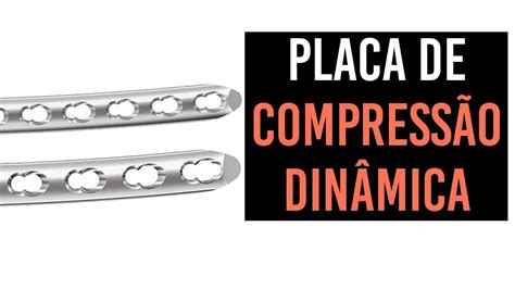 Placas De Compress O Din Mica Em Ortopedia Veterin Ria Youtube