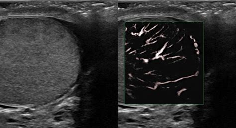 Ultrasound Exams In Edmonton Alberta Insight Medical Imaging