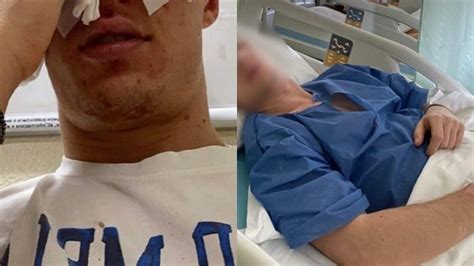 Pestato a sangue perché gay la denuncia di Diego Ho paura Anche una donna mi ha aggredito