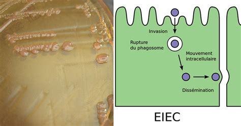 Diseases Notes | Microbe Notes