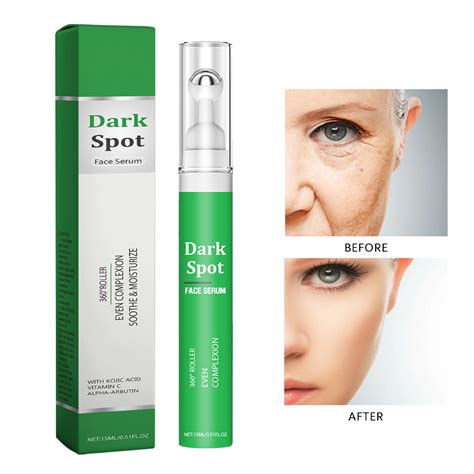 Dark Speckle Remover For Face With Roller Dark Speckle Corrector For