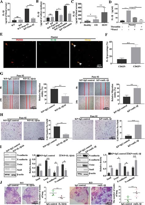 Panx Promotes Pdac Cell Invasion And Metastasis By Inducing The