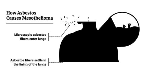 Asbestos Exposure Dangers How You Re Exposed Prevention