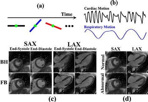 A Continuous Data Acquisition B Cardiacrespiratory Motion