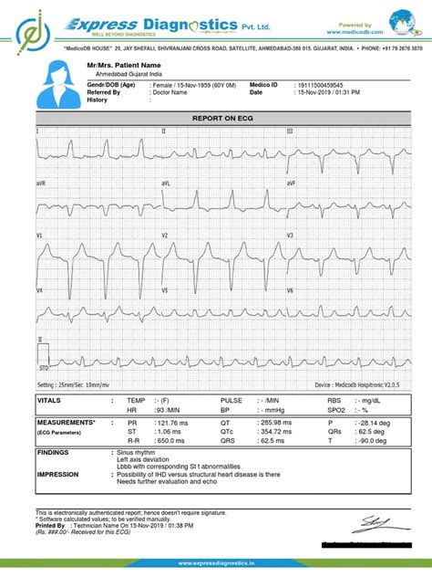 Ecgreport Sample Pdf