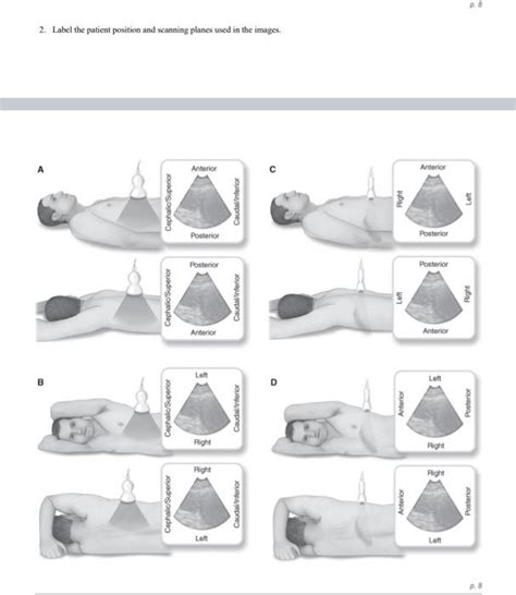 Solved 2 8 2 Label The Patient Position And Scanning Planes Chegg