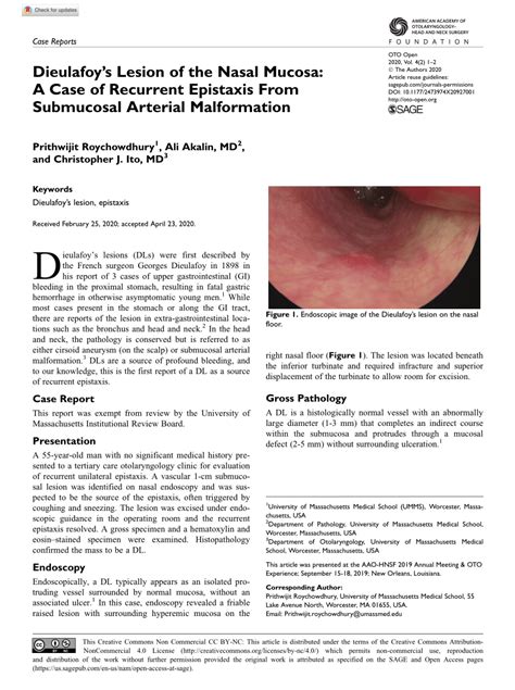 Pdf Dieulafoy’s Lesion Of The Nasal Mucosa A Case Of Recurrent Epistaxis From Submucosal