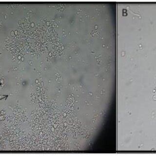 A Chlamydospores And Blastospores On Casein Agar B Germ Tube