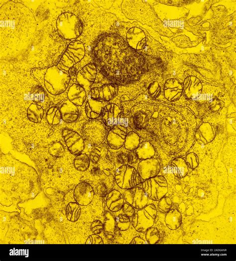 False Colour Transmission Electron Micrograph Tem Of A Thin Section