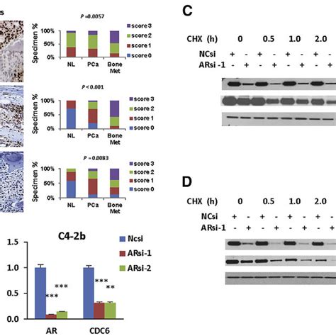 CDC6 Is Induced During PCa Progression And Is Positively Correlated