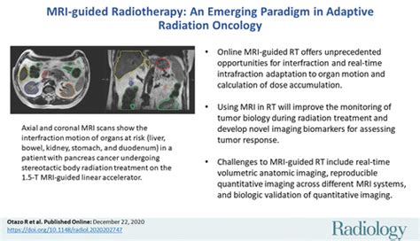 MRI Guided Radiation Therapy An Emerging Paradigm In Adaptive