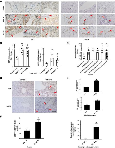 Molecular Characterization Of Biliary Tract Cancer Predicts Hepatology