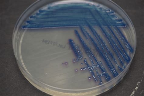 Chromogenic Agar Cmp