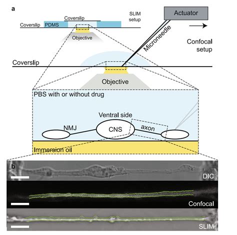 Coupled Circumferential And Axial Tension Driven By Actin And Myosin