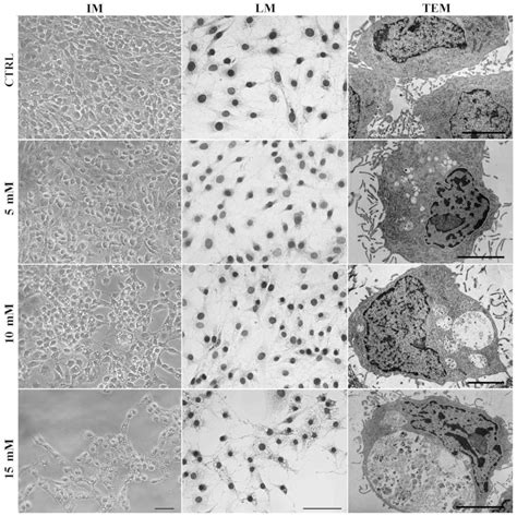 Lidocaine Induces Protective Autophagy In Rat C6 Glioma Cell Line