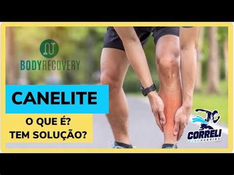 Dor Na Canela Ao Correr Ou Canelite O Que Pode Ser O Que Fazer Como