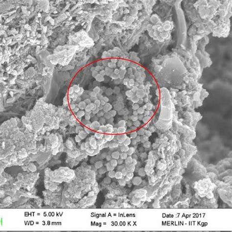 Cocci Bacteria Under Microscope