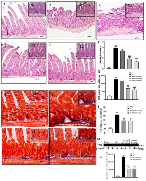 Effect Of Kyp 2047 On Histological Damage Of Intestinal Tissue Mpo