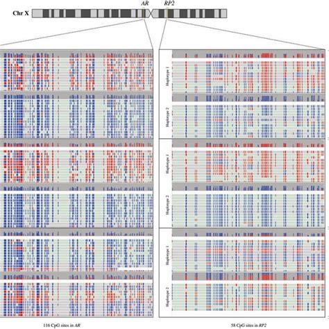 Visualization Of Xci Ont Result Using Integrative Genomics Viewer Igv