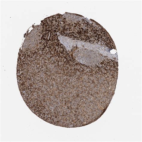 Tissue Expression Of FCGR3A Staining In Spleen The Human Protein Atlas