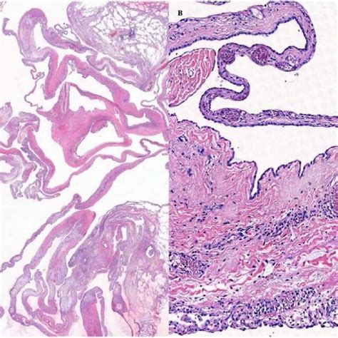 Histopathological Results Histopathological Examination Of The Lung Download Scientific