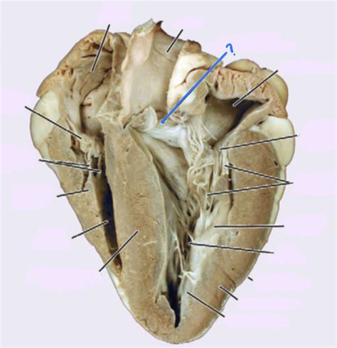 Sheep Heart Flashcards Quizlet