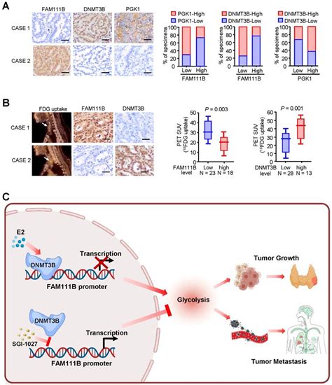 DNMT3B Mediated FAM111B Methylation Promotes Papillary Thyroid Tumor