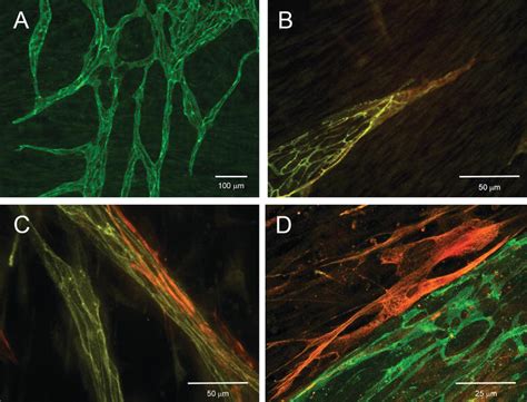 Vascular Smooth Muscle Cells Vsmcs In Blood Vessel Tissue Engineering