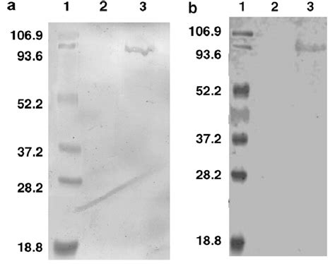 Western Blot Detection Of Rpa Using Purified Fab Fragments The Fab