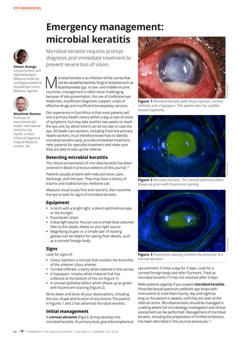 (PDF) Emergency management: microbial keratitis