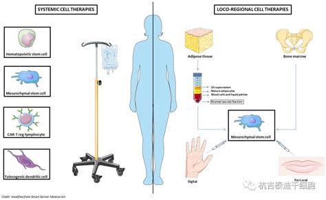 系统性硬化症的细胞疗法：从造血干细胞移植到干细胞疗法 杭吉干细胞科技