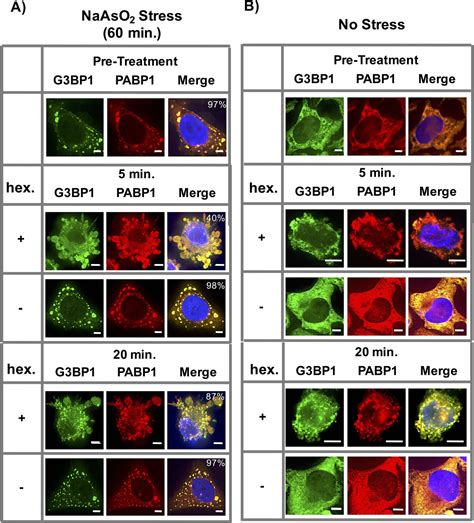 Distinct Stages In Stress Granule Assembly And Disassembly Elife